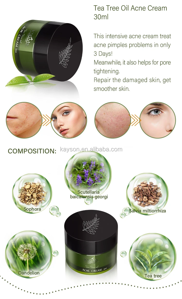 Natural Indian Organic Clay and Pure Dead Sea Mud Cream with Vitamin C for Moisturizing Acne Blemish Skin Care on Face