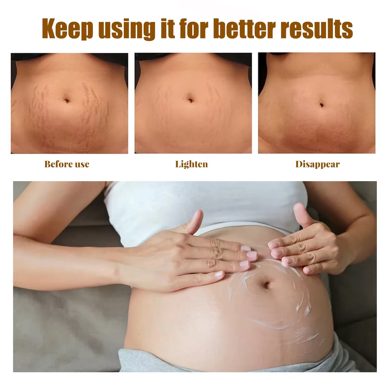 Improve Skin Relaxation Improve Skin Relaxation Stretch Marks Scar Removal Cream After Pregnancy Anti Stretch Mark Cream
