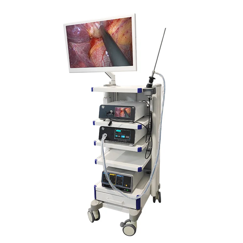 Медицинская система эндоскопа гистероскопии набор гинекологии для гинекологической диагностики