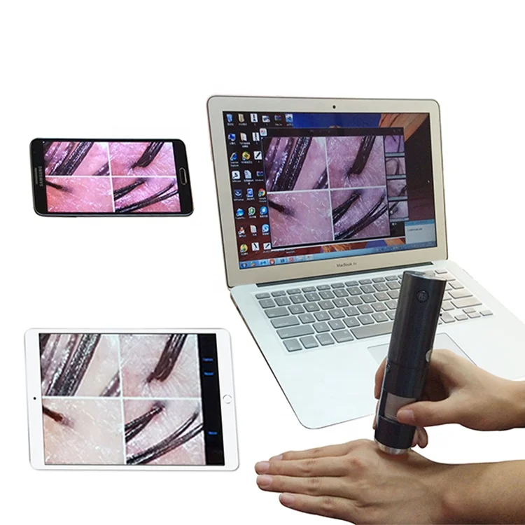 Hot sell HD portable WiFi mini Multifunctional Digital Microscope for Skin and Hair Scalp analysis