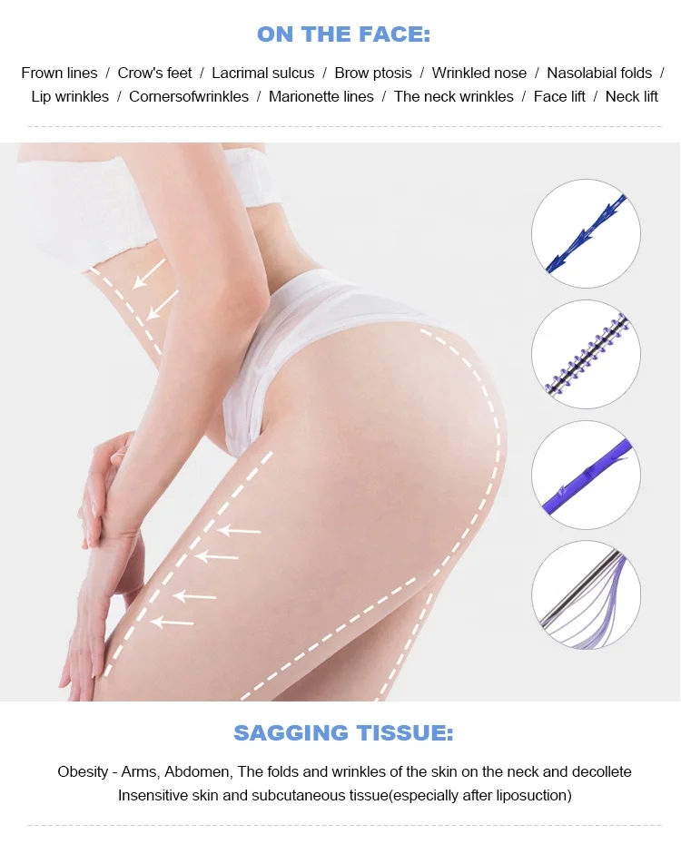 Korean surgical suture pdo cog  molding cog  lifting threads