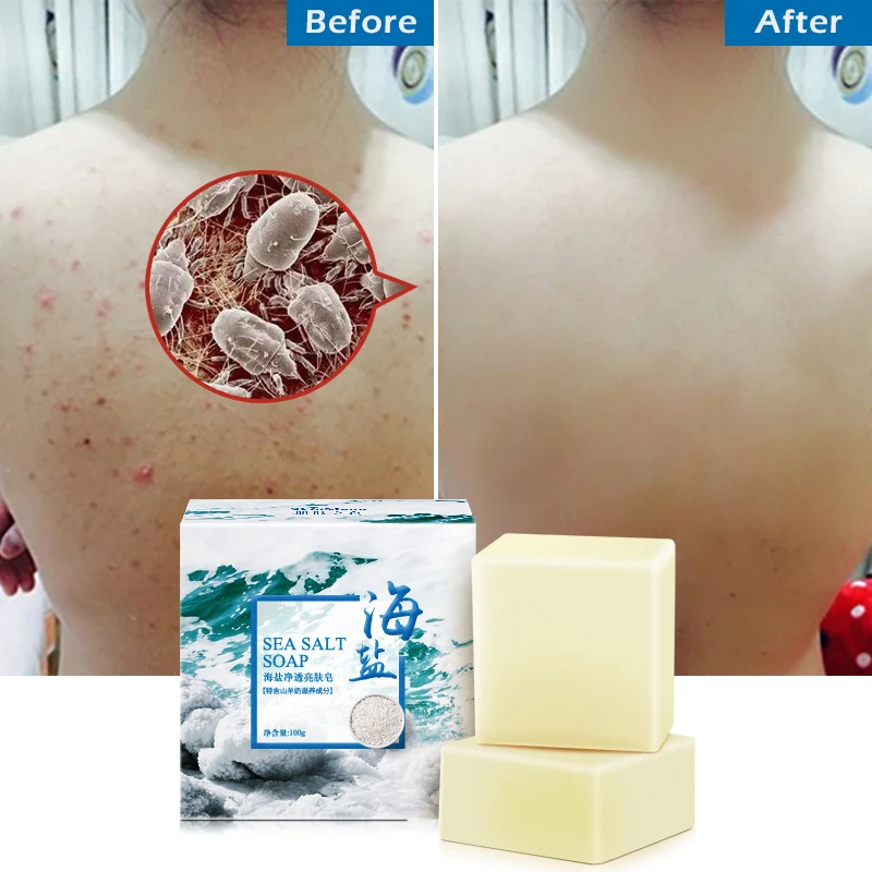 100g Removal Pimple Pore Acne Treatment Sea Salt Soap Goat Milk Moisturizing Glycerin Soap Base Whitening