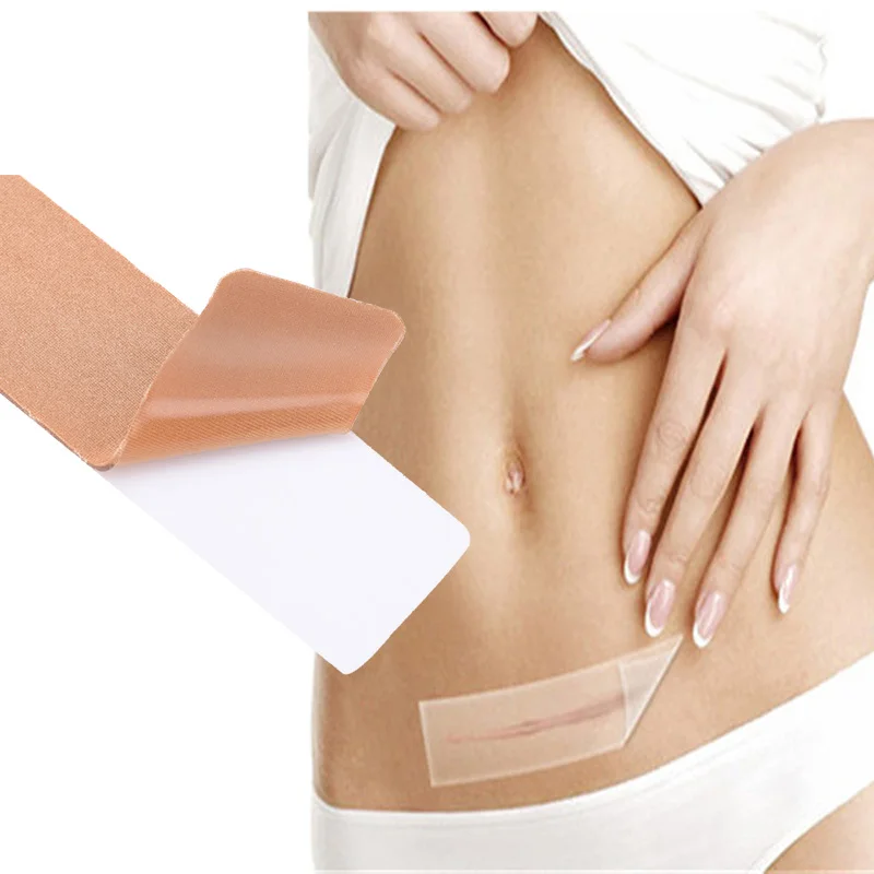 Silicone scar tape New Product Mark Patch Scar Removal silicone scar sheet