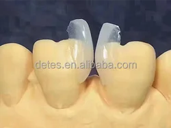 Removable full denture Gingival mask Splint Orthodontic model porcelain veneers teeth zirconia ceramic false teeth flexible