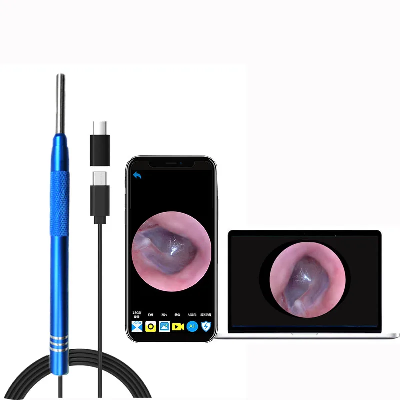 3 in 1 Ear Endoscope Camera Ear Cleaning Medical Otoscope HD earwax cleaner  Wax Removal Tool Android Ear Pick Health Care