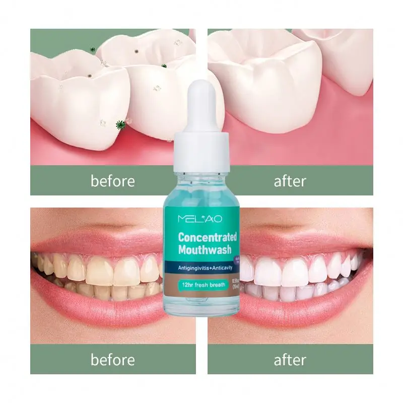 oem Top Selling Private label organic Bad Breath Treatment Remove Oral Odor Plaque Stains Concentrated Mouthwash