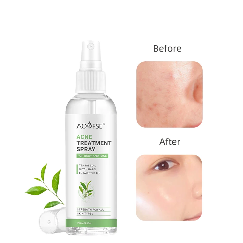 Acne Treatment Water Tea Tree Acne Prone Skin Clear Toner with Shrink Pore Acne Toner
