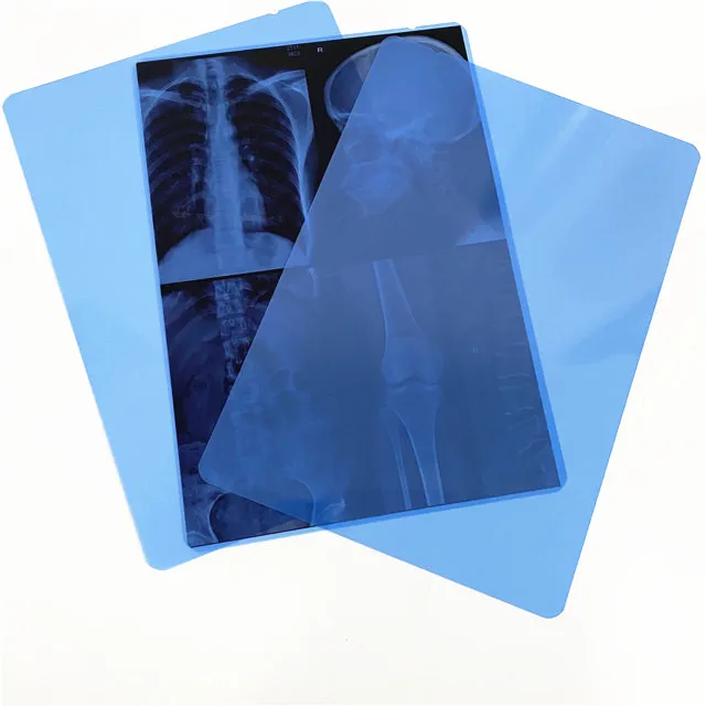 high quality 35x43 inkjet blue medical x ray film for epson  digital x-ray film for CT