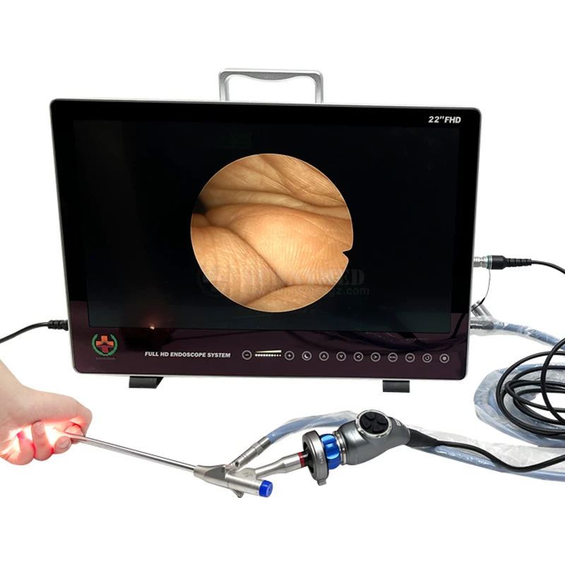 SY-PS050 высокое качество все в одном Full HD эндоскопическая система для лапароскопии гистероскопии артроскопии