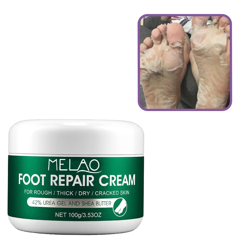 Best Hand And Foot Whitening Cream Foot Cream Deep Repair Callus Remover Foot Peeling Cream For Cracked Heels