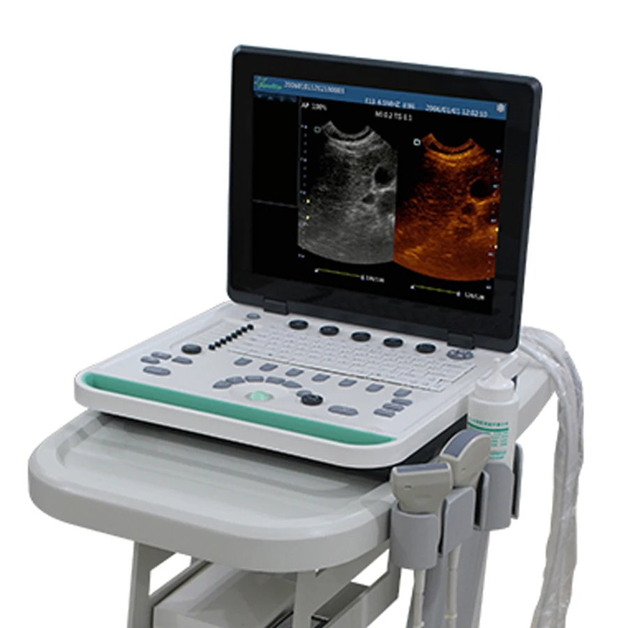 
SS-9 Portable Laptop Color Doppler Ultrasound Machine Scanner Convex Linear Transvaginal Probe 