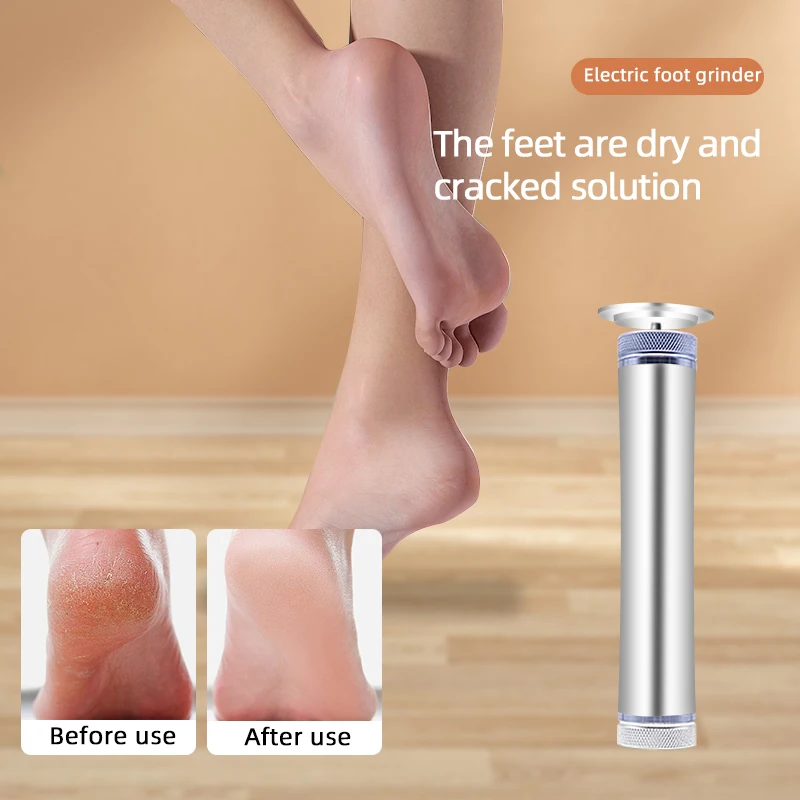High Quality Professional Callus Remover Rechargeable Electric Foot  Callus Remover Electric Foot File Custom Color