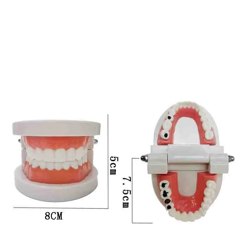 Life Size Tooth Decay Model For Oral Care Teaching Dental Tooth Care Model For Kids