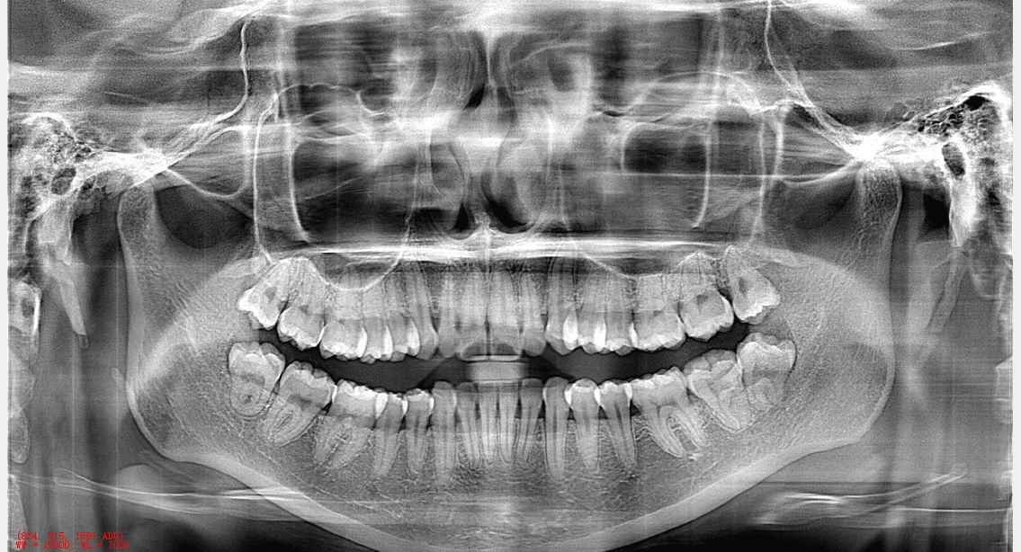 3D Medical Equipment Multifunctional CbCT X-ray Dental
