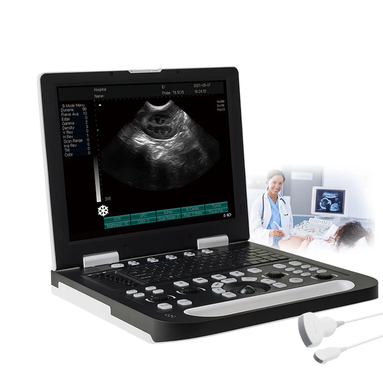 Hot Selling Veterinary Portable Ultrasound Scanner Portable Full Digital Animal Ultrasound Machine 3d