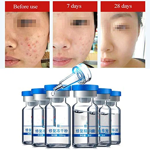 
Lyophilized Powder Acne Scar removal Serum Anti-wrinkles Organic and Natural Ingredients 