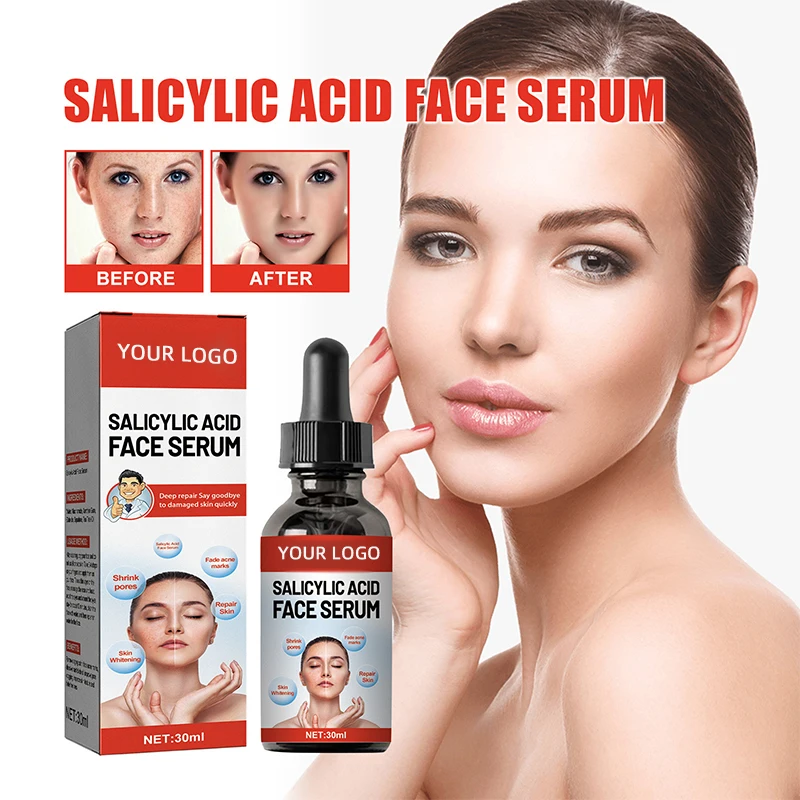 Nicotinamide Freckle Removal Serum with Salicylic Acid Shrinks Pores and Moisturizes Face OEM Supply Skin Care Products