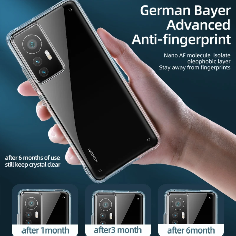 Anti Yellow Case for Xiaomi 12 11 Pro Ultra 11T TPU Frame Hard Back Cover Clear Case for Redmi Note 11 10 Pro 5G K40 Poco X3 GT