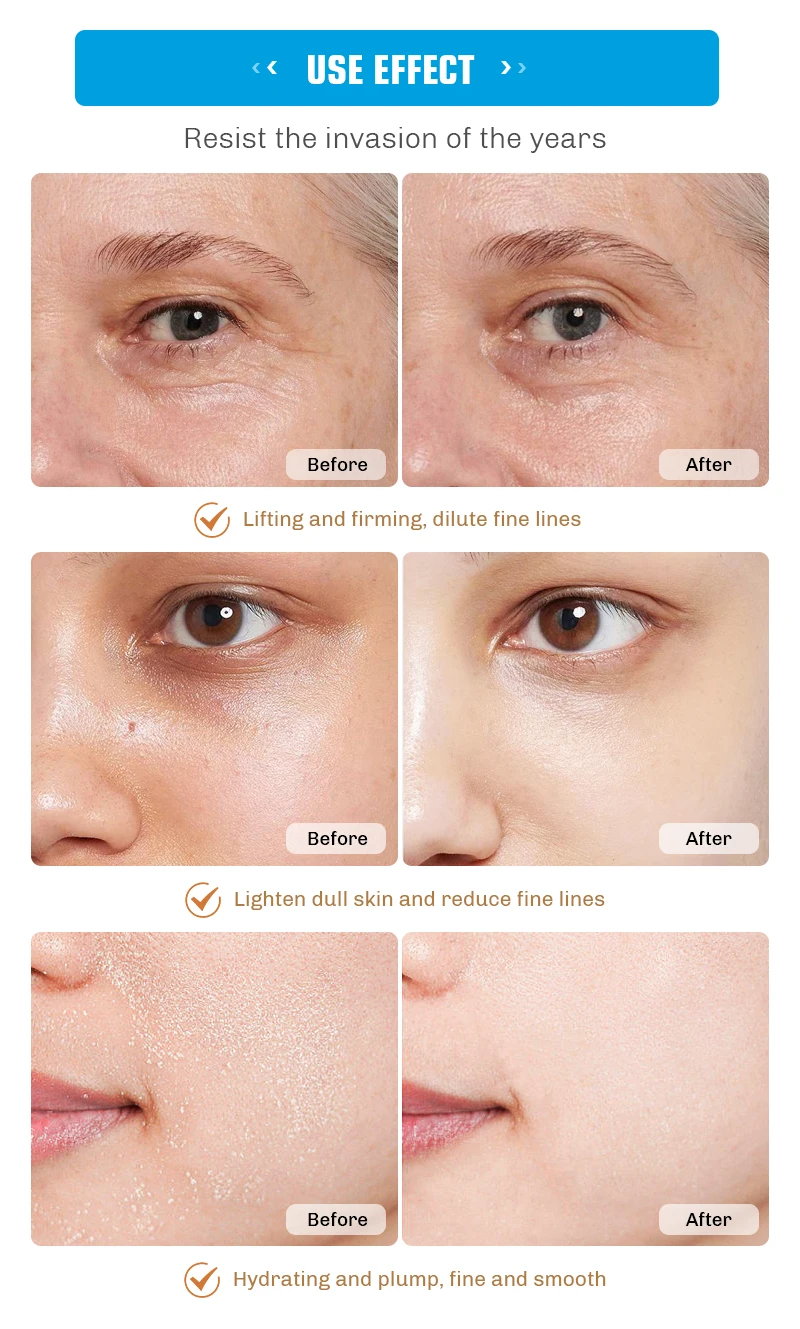 Hot Selling OEM ODM Beauty Anti-aging Whitening Facial Serum Skin Care Vitamin E hyaluronic serum Face Essence Capsules