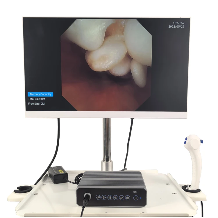 ODM customization great quality medical laparoscopic endoscopic USB HD 1080P endoscope camera system