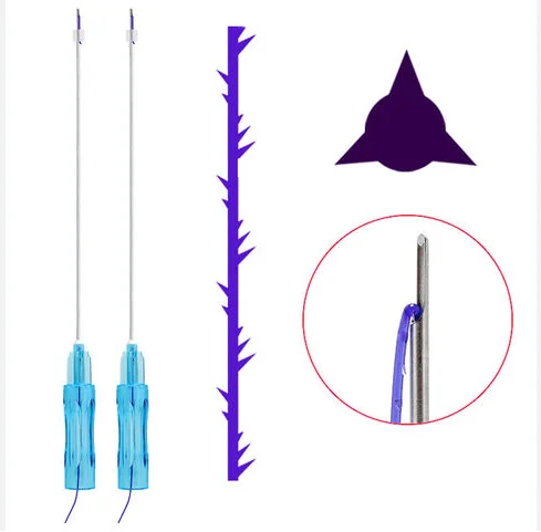 good effect move wrinkle Pdo Plla Pcl Thread Lift thread v derma pdo for face beauty lifting