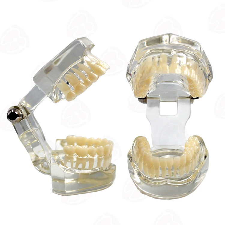 Medical science transparent dental teaching tooth model with nerves for medicine pathological tooth model