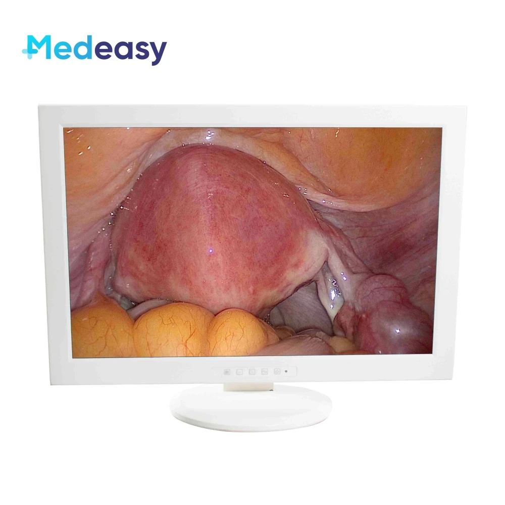 Medical Full HD Laparoscopic Tower Endoscopy Endoscope Camera System for Laparoscopy Surgery