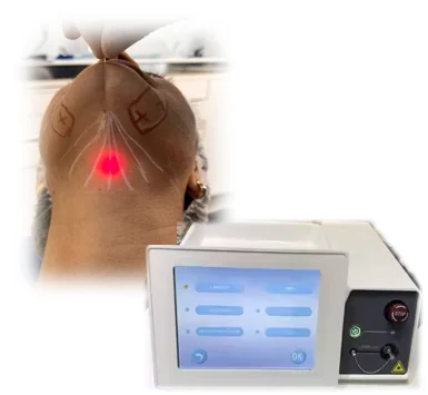 Endo Face Lift Medical Fiber Optic Cable 980nm + 1470nm Diode Laser Liposuction Reusable Dental Cable Surgery Optic Laser Device