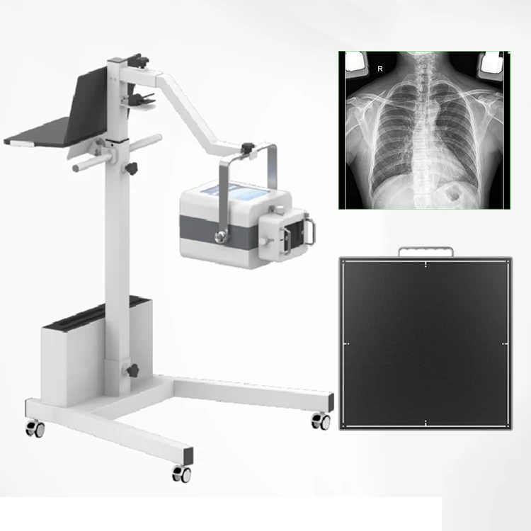 Fully Digital Wireless X Ray DR Flat Panel Detector X Ray Machine
