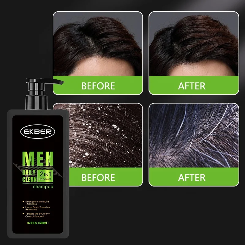 Частная торговая марка 2 в 1 Шампунь против перхоти для мужчин Shampoing Sans Sulfate Мужской