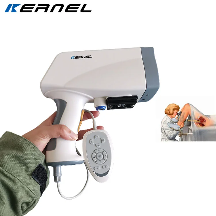 18x Optic Magnification Optical Medical Instrument Gynecology equipment Trolley type Colposcopy Vagina digital colposcope