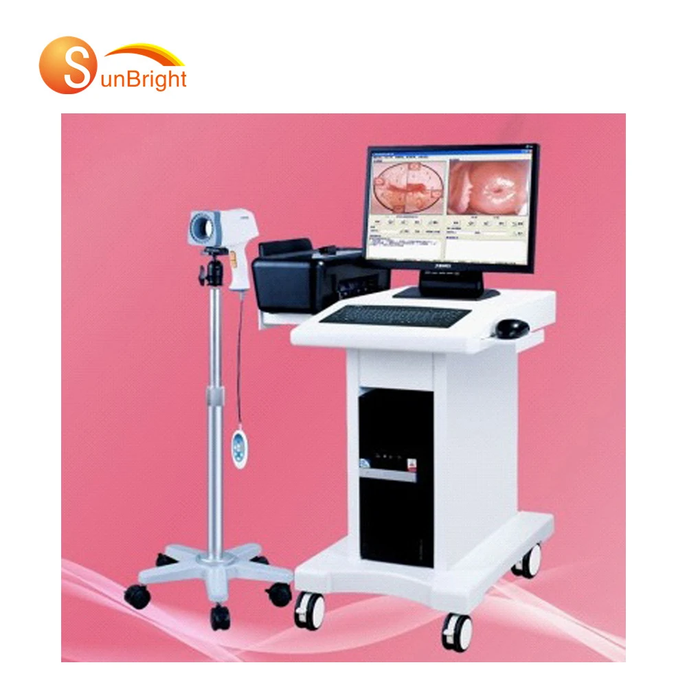 Цифровая тележка Colposcope Sony High Resokution Electronic Colposcopy Лучшая цена