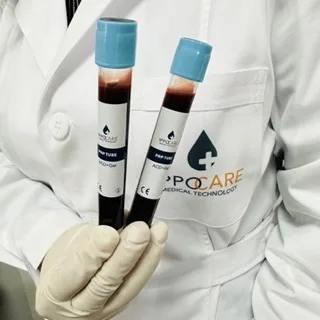 YIbote best selling 12ml disposable products with good quality prp tube for face and hair