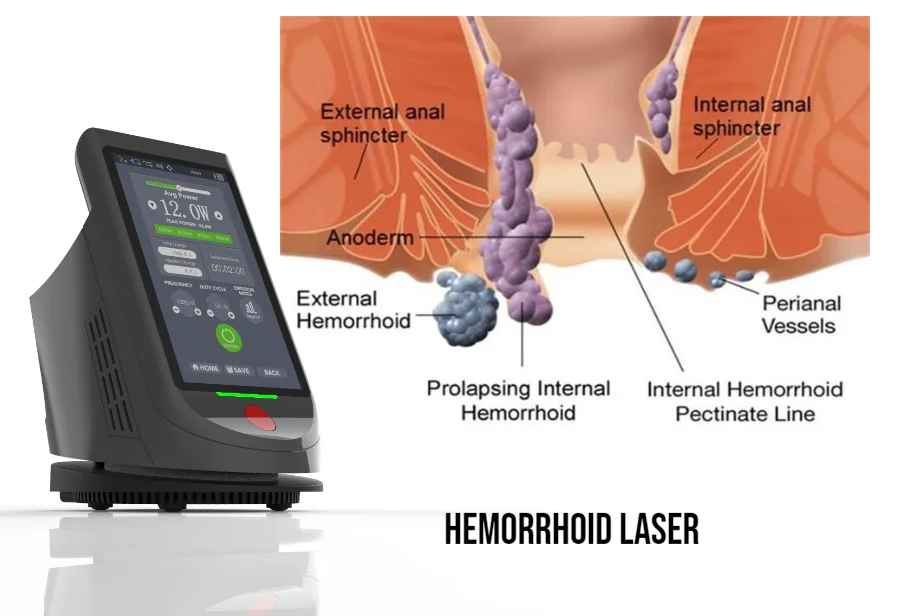 980nm Surgical piles laser  for hemorrhoids and fistulas