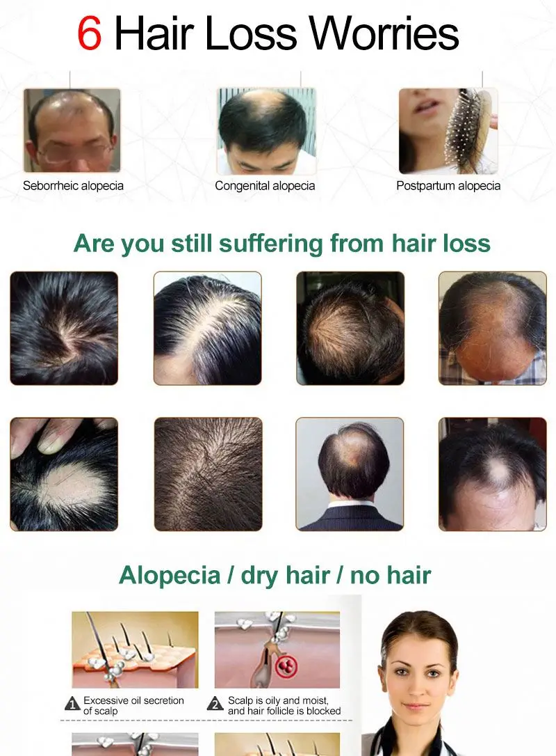 private label Wholesale 30ml Ginger Oil 7 Days Hair Growth Essential Oil For Hair Loss Treatment Regrowth Serum