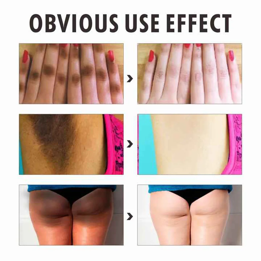 Private Label Natural Organic Skin Moisturize Care Oil Whitening Removing Dark Spots Body Massage Oils