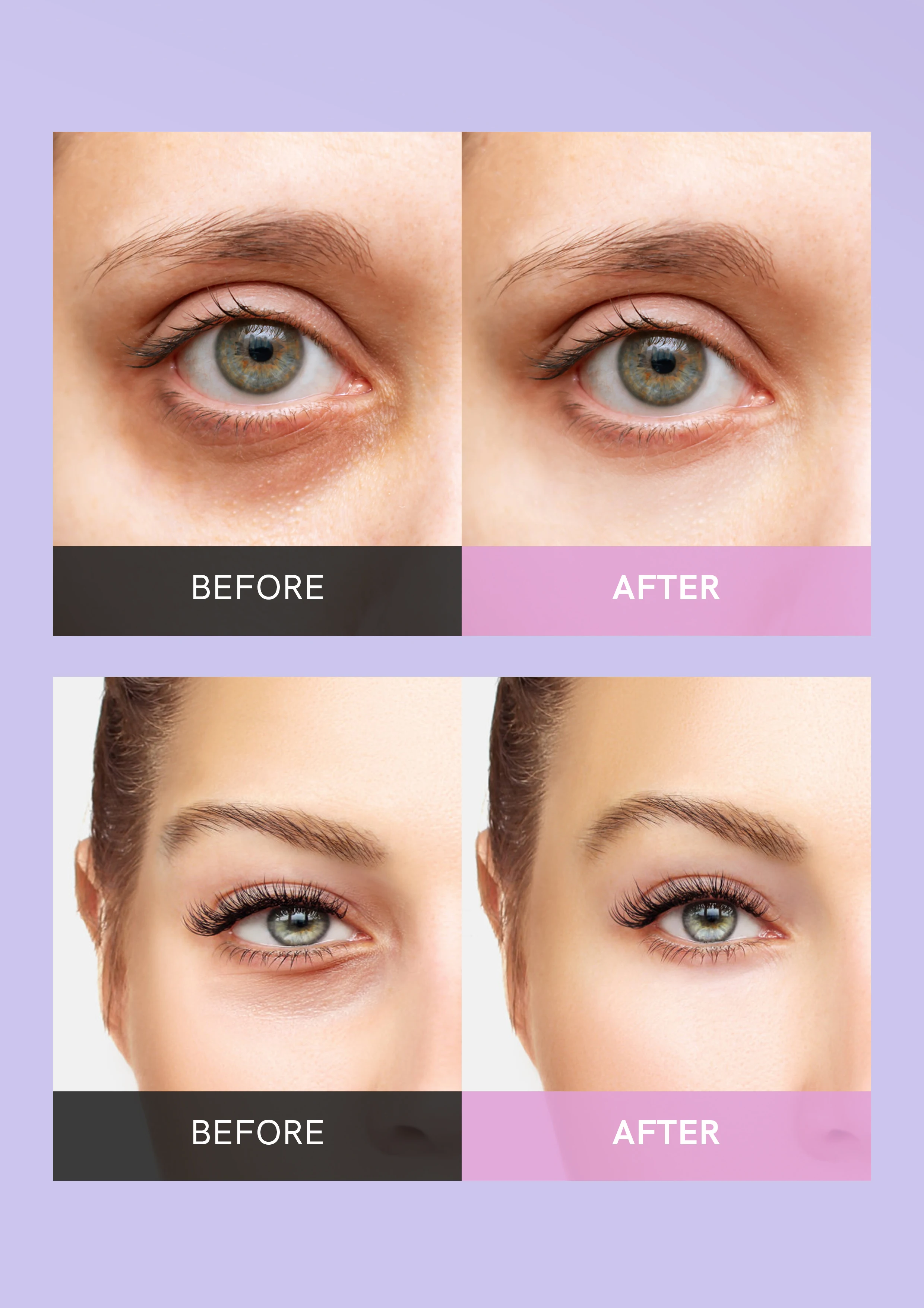 Wholesale Increase Hydrating Reduce Wrinkles Improve Dark Circles Eye Mask Niacinamide Hyaluronic Acid Eye Mask Patches