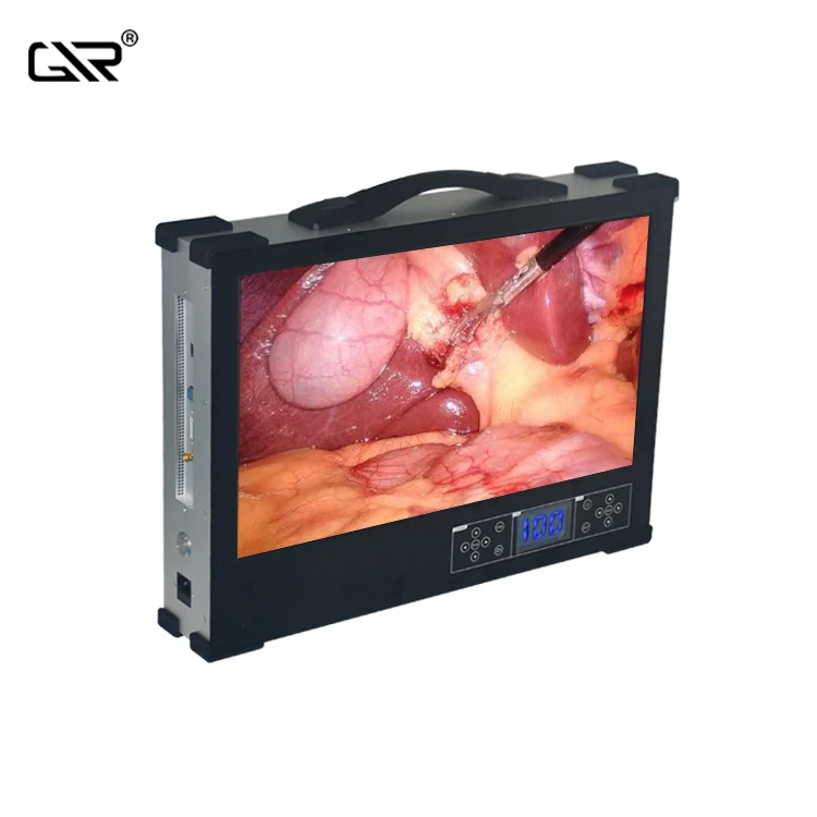 Medical Full HD Endoscope Camera Integrated With LED Light Source and 24-inch Monitor