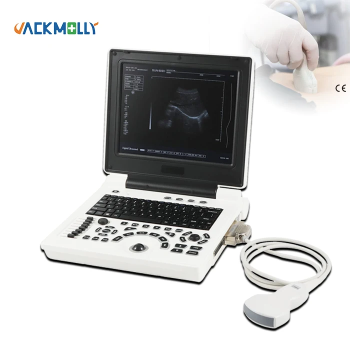 JM-806H Diagnostic Ultrasound System 2D ultrasound Imaging Ultrasonic Machine