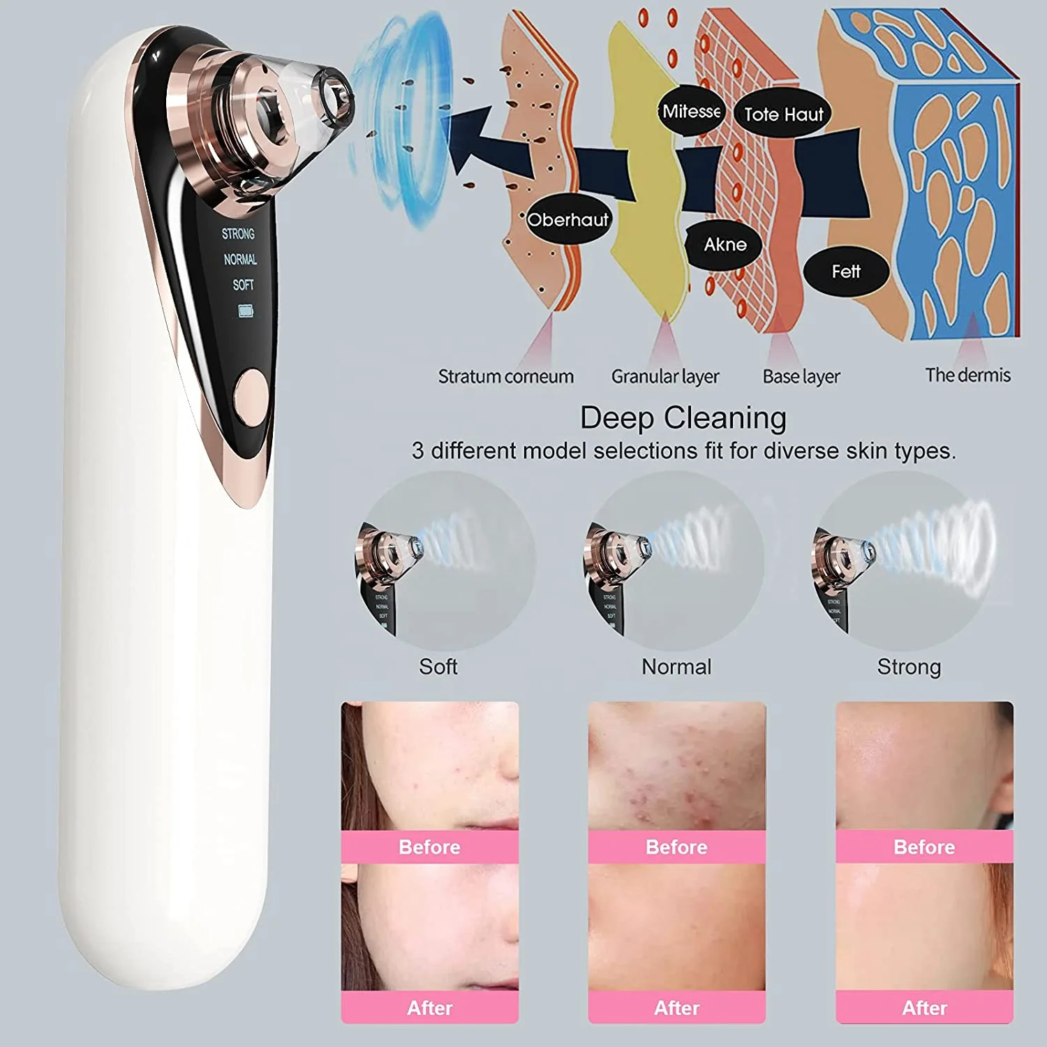 Blackhead Acne Pore Facial Cleaning Brush Black Head Remover Visual Blackhead Remover Beauty Apparatus