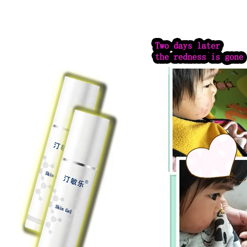 Organic Hydrating Nourishing Face Skin  Effective Scavenger Of Free Radical Scar And Acne Mark Removal  Gel