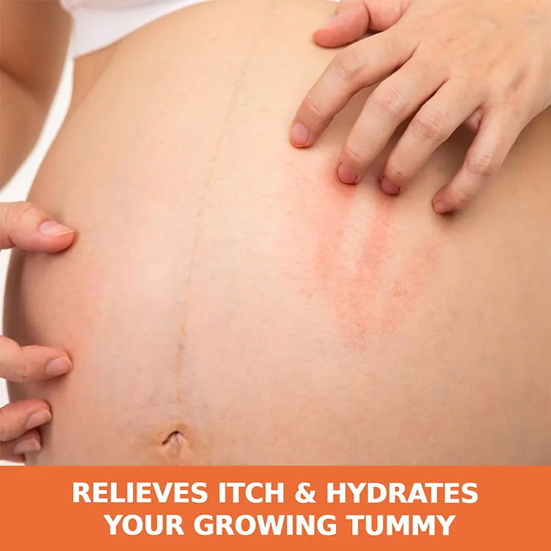Cocoa Butter Formula Soothing Oil With Vitamin E Dry Itchy Skin Relief Pregnancy-Safe Anti-Itch Body Oil 5.1 Ounces
