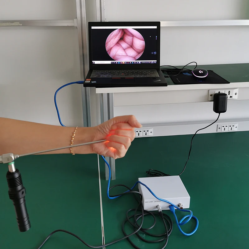 portable medical endoscopy hd usb endoscope camera for ent surgery system