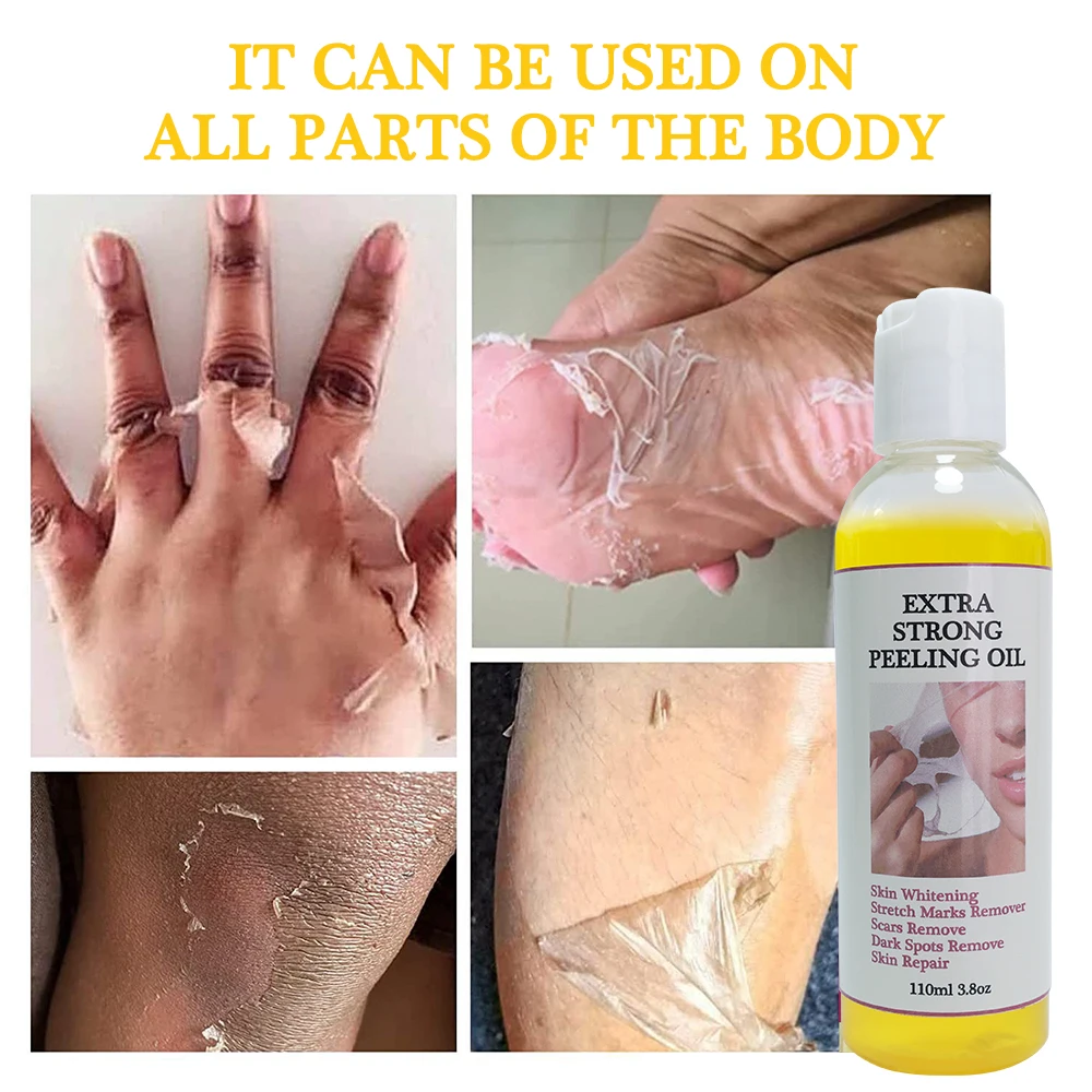 Private Label Skin Revitalizer Yellow Orange Peeling Oil For Face And Body