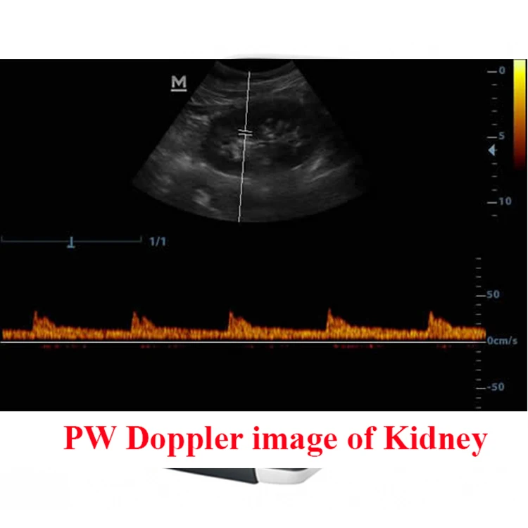Mindray DP-20 Ultrasound Scanner Price Medical Instruments B/W Portable