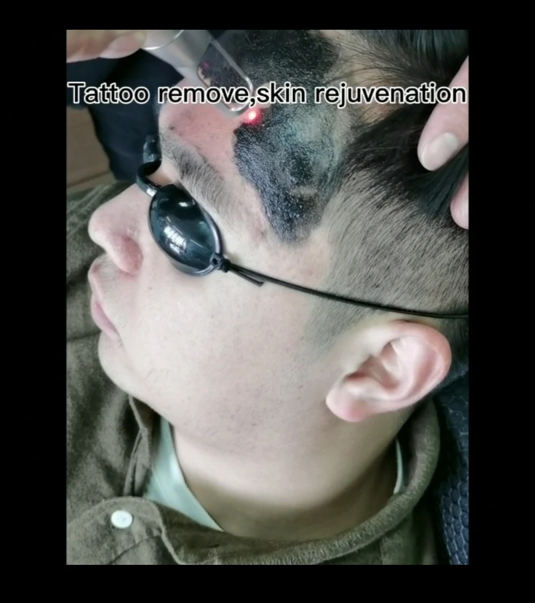 
Professional machine picosecond laser equipment 