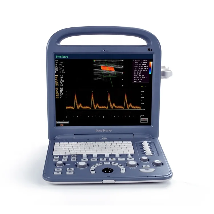  Sonoscape s2 medical ultrasound instruments/color doppler
