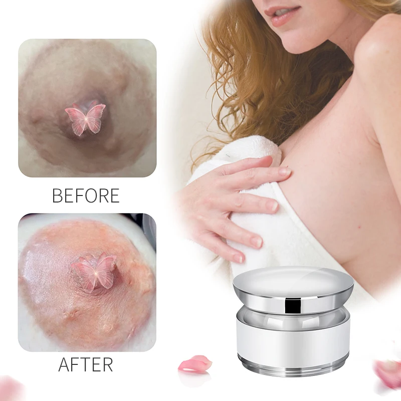 Deep Nourishment Private Parts Pink Tender Cream Intimate Pink Tender Skin