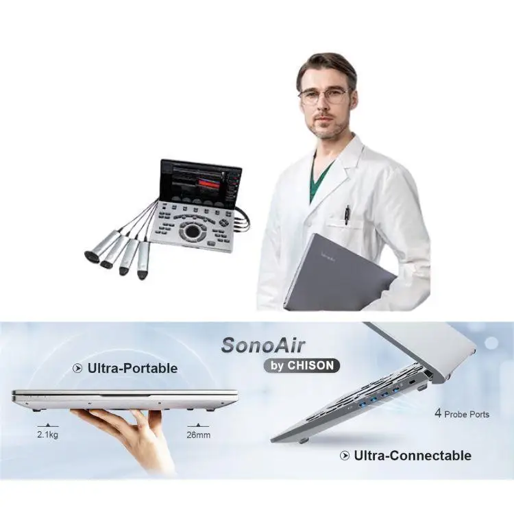 Portable Chison Ultrasound machine Sonoair 70 Ultrasound  3d 4d scanner color doppler Ultrasound System use for PT  MSK Vascular