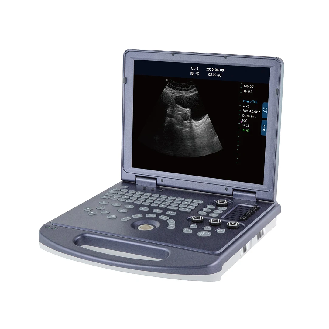 Vet medical system veterinary diagnostic animal check pregnancy ultrasound scanner